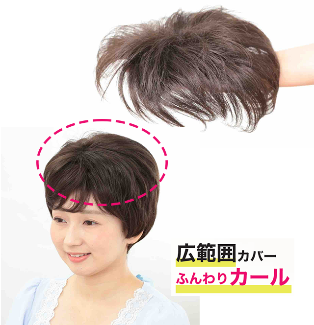 関連会社の有限会社ルネスでは「ウィッグ WIG ルネス」として医療用かつら、簡単ウィッグ、カチューシャなどヘアアクセサリーを取り扱っている。
