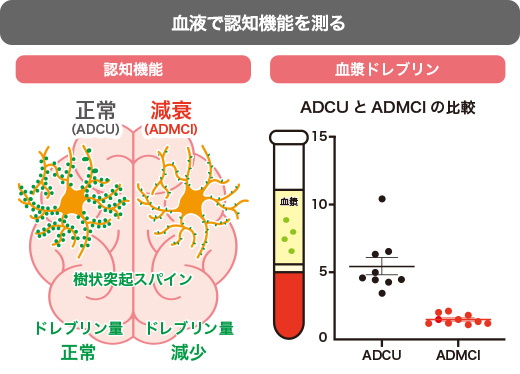 血液中のドレブリン量を Syncheck™ （研究用試薬）で測定すると、アルツハイマー病で「認知機能が保たれている状態（ADCU）」と「軽度認知障害の状態（ADMCI）」を識別できる